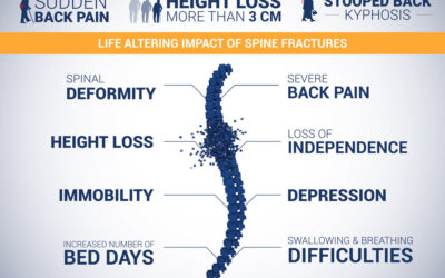 Did You Know That Up to 70% of Spine Fractures Remain Undiagnosed?