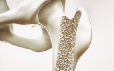 55 Fast Facts About Osteoporosis & Bone Health