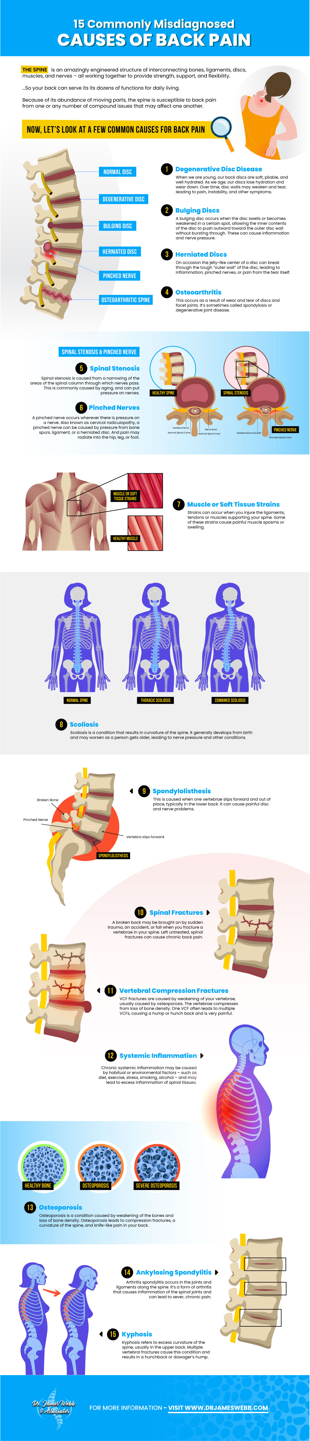 Herniated Disc and Symptoms (Infographic)