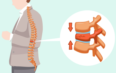 Spinal Compression Fractures: Causes, Symptoms, Treatment and Prevention Infographic