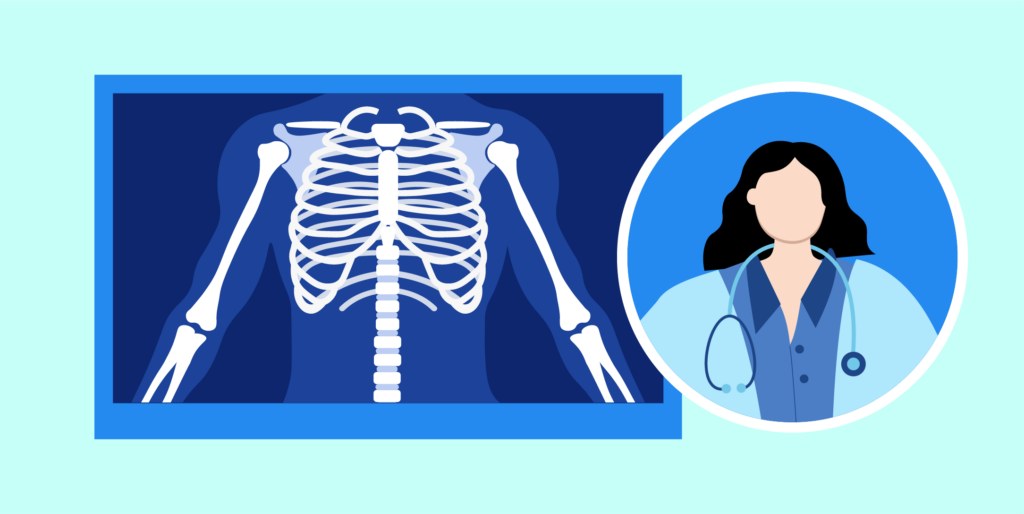 Bone Density Test